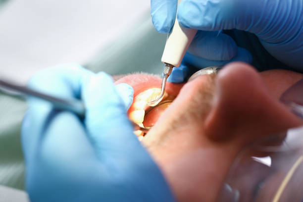 Best Emergency Dentist for Knocked-Out Tooth in Gassville, AR